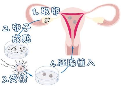 关于孕妈代妈应聘机构
